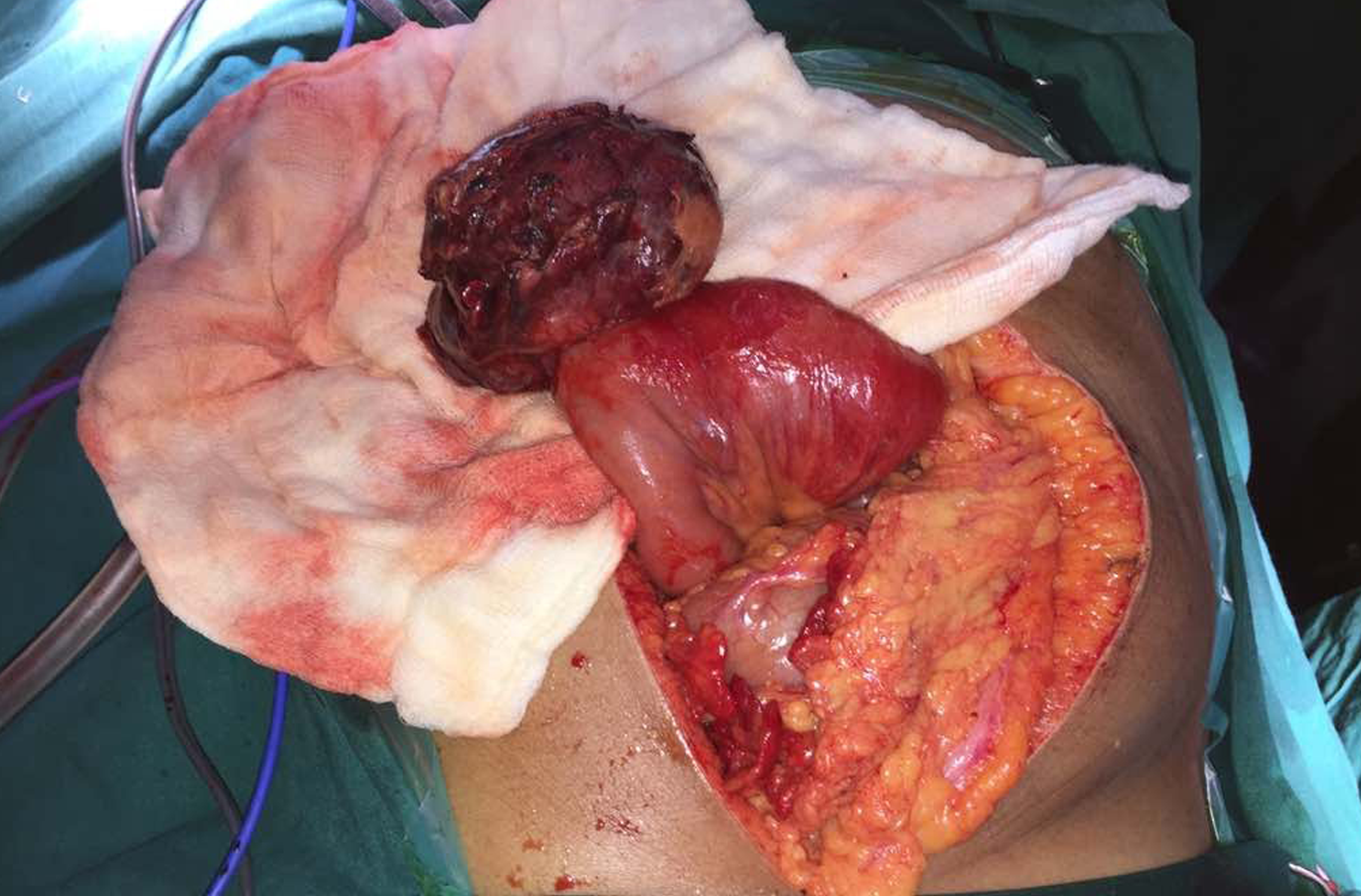 Cancer Surgeon in Mumbai