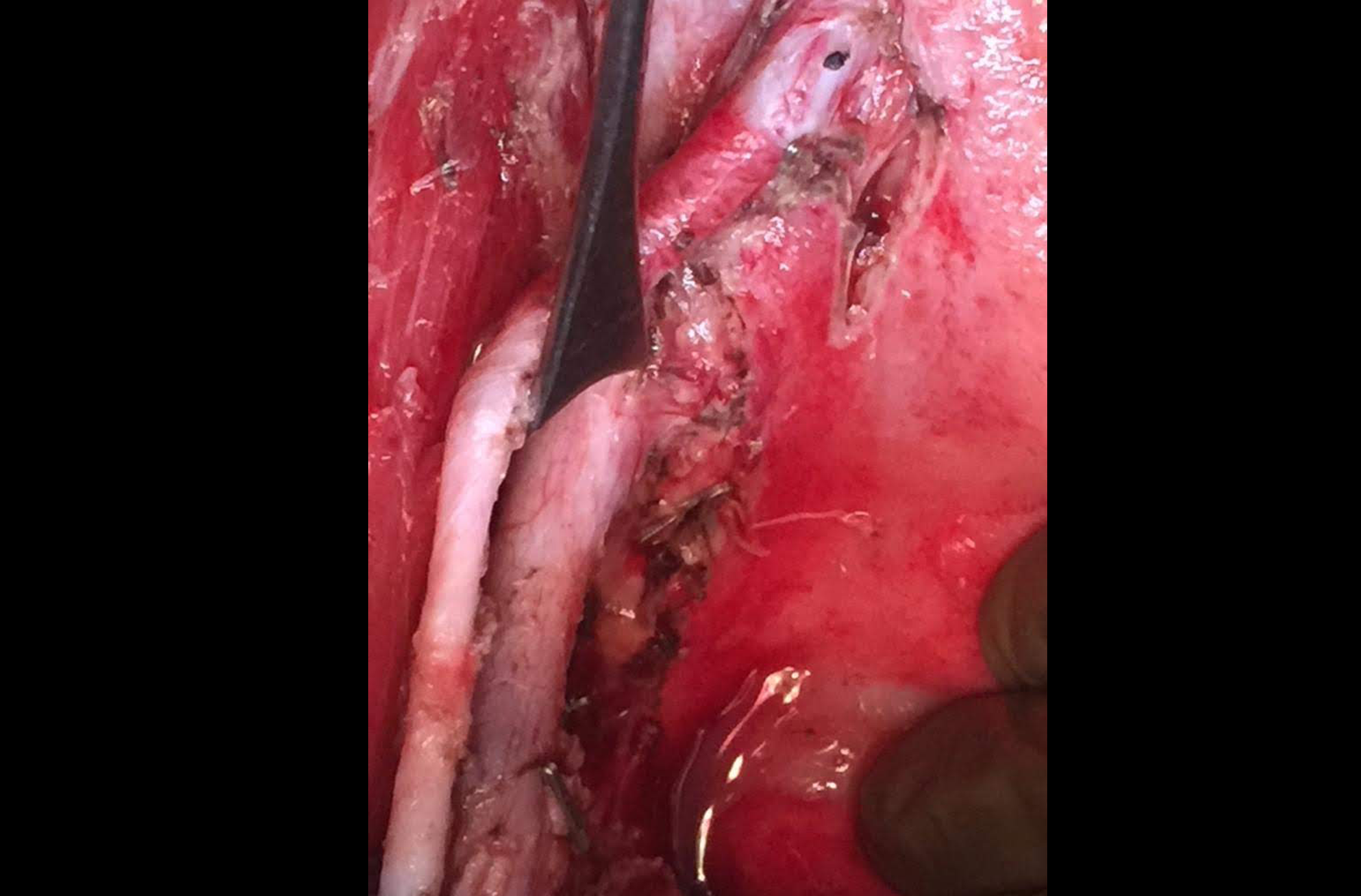 Onco Surgeon in South Mumbai